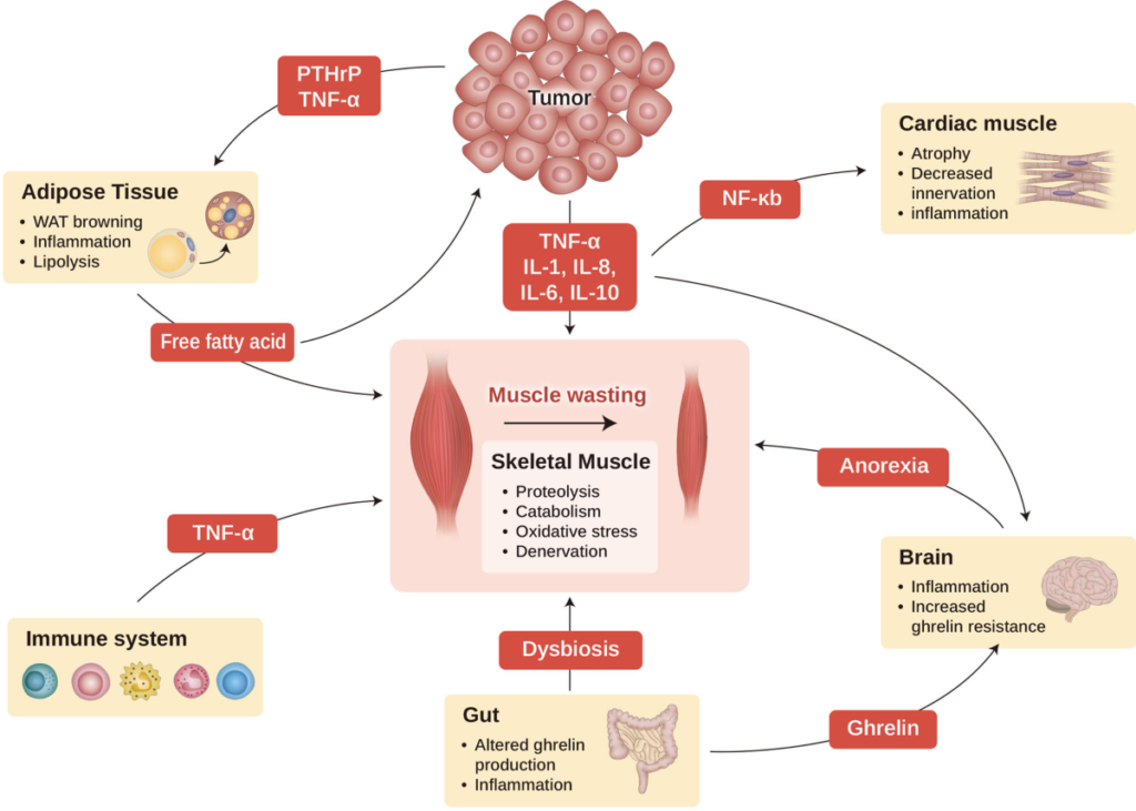 Supportive and Palliative Oncology: Clinical Protocols for Quality of Life 3 Cancer Chexia
