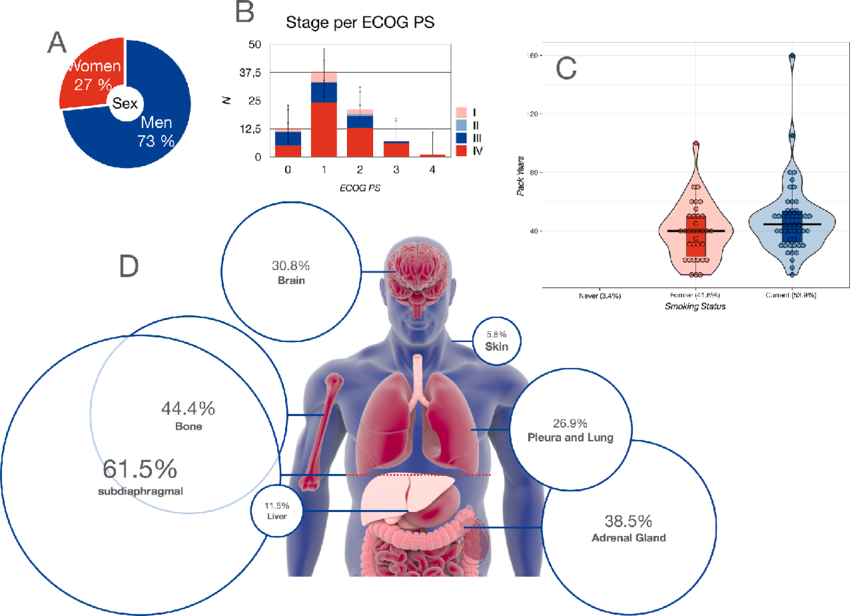 ROS1 Gene Fusions in NSCLC: Targeted Therapies and Clinical Management 1 Clinical characteristics of patients with small scale ROS1 mutations Sex proportion
