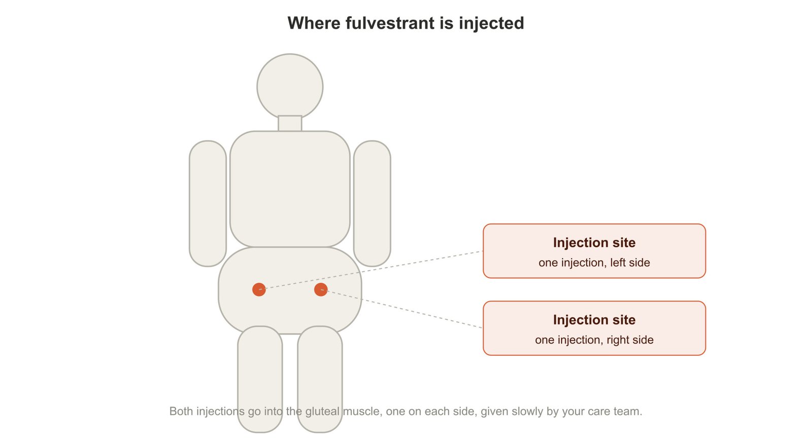 diagram injection site scaled